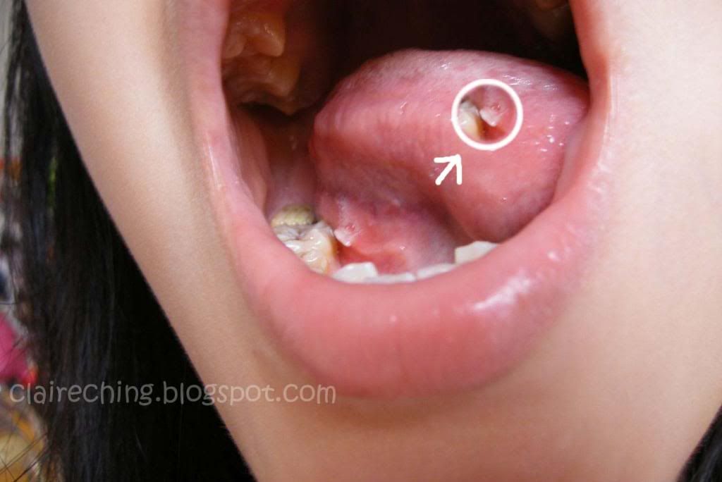 Healthy Tongue Photos