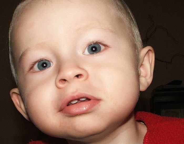 boy showing teeth