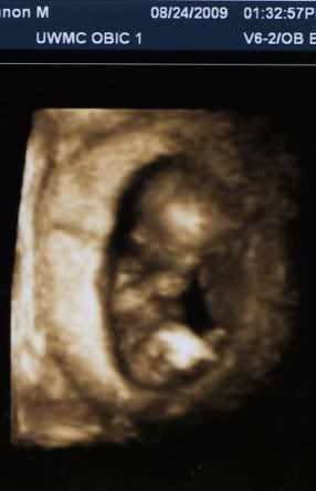 12 5 week ultrasound. 12 weeks, 3 days.